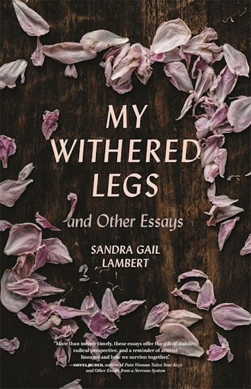My Withered Legs and Other Essays
